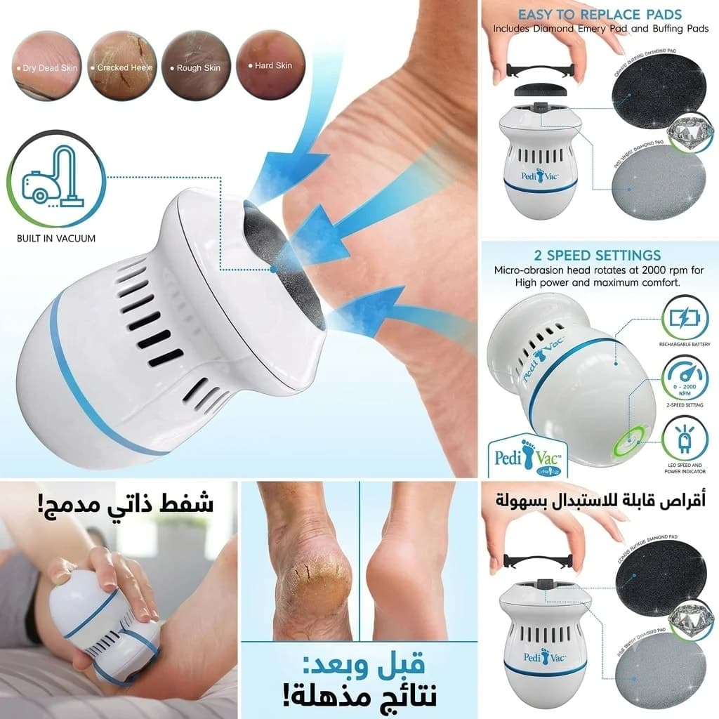 مبرد للقدمين واليدين مضاد للجلد الميت مع مكنسة كهربائية مدمجة  3