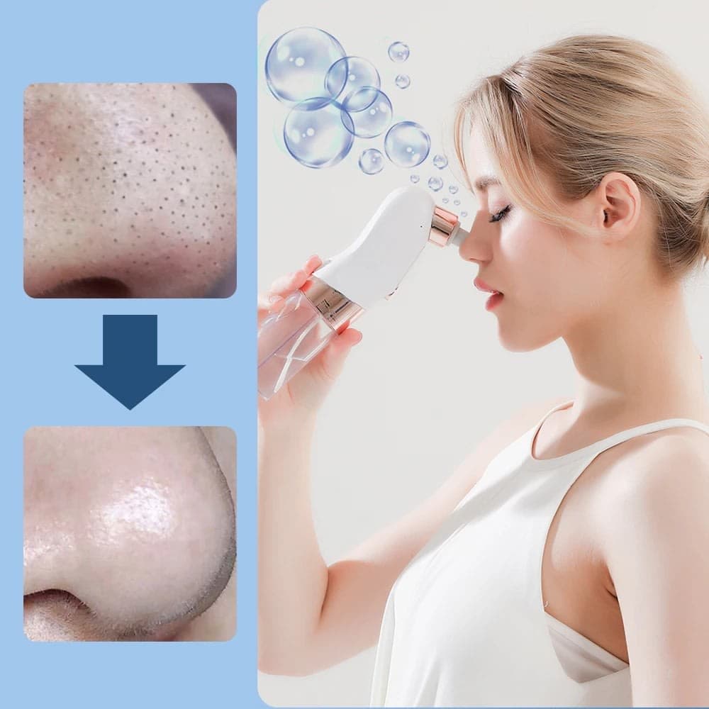 Aspirateur de Point Noirs avec 6 têtes d’aspiration et 3 modes – جهاز إزالة الرؤوس السوداء 6