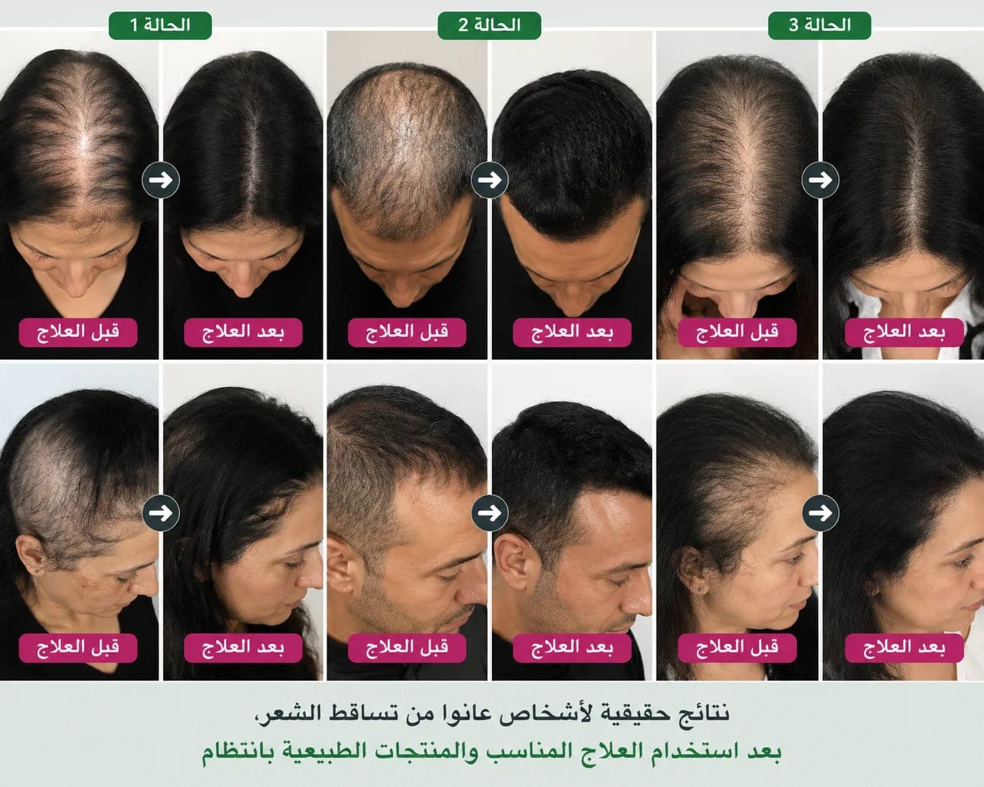 شامبو السدر  2