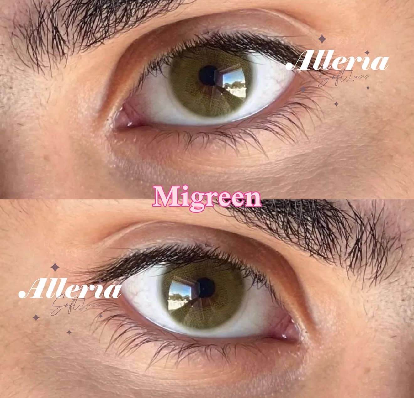 Migreen