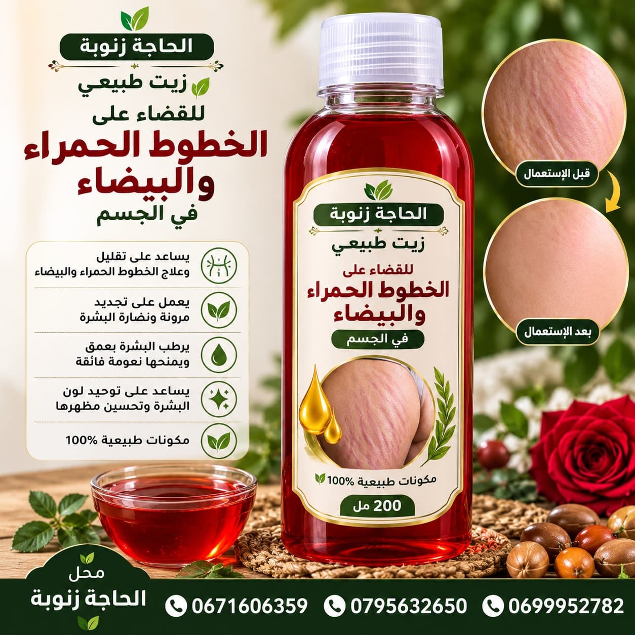 علاج خطوط بيضاء حمراء من جسم